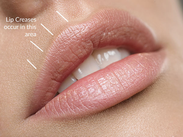 selston cosmetic clinic-lip crease